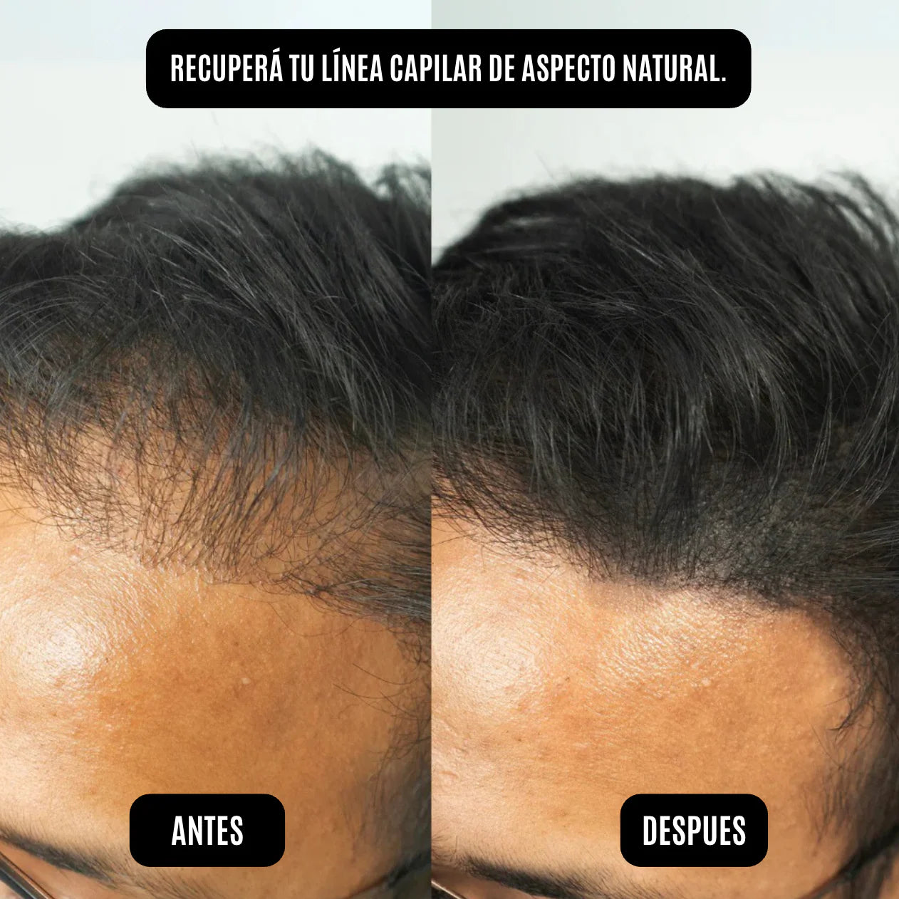 Polvo Con Fibra Capilar Rellenador